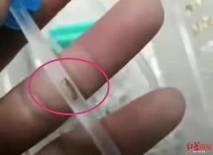 输液器进虫，医院别假装“高度重视”