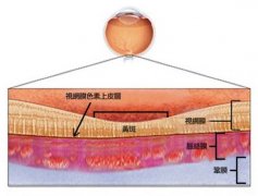 深圳希玛眼科医院“中浆”不是中奖，严重可危及视力